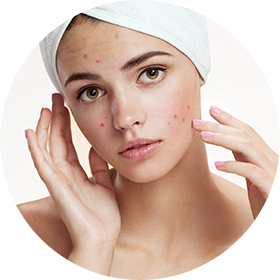 Skin tightening acne