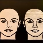 botox-blog